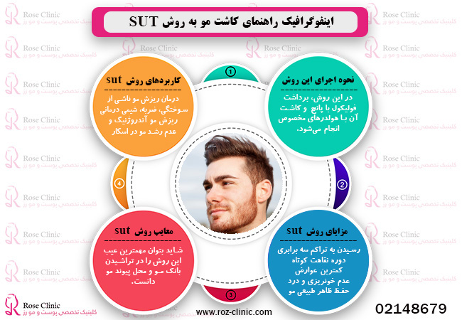 اینفوگرافیک راهنمای کاشت مو به روش sut