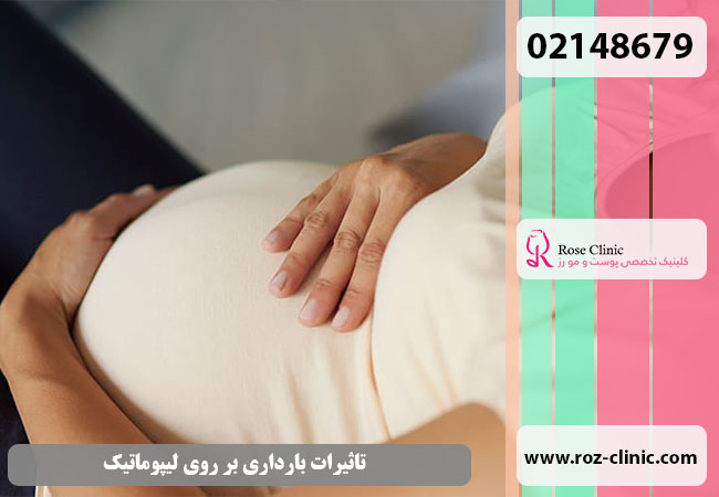 تاثیرات بارداری بر روی پیکرتراشی بدن
