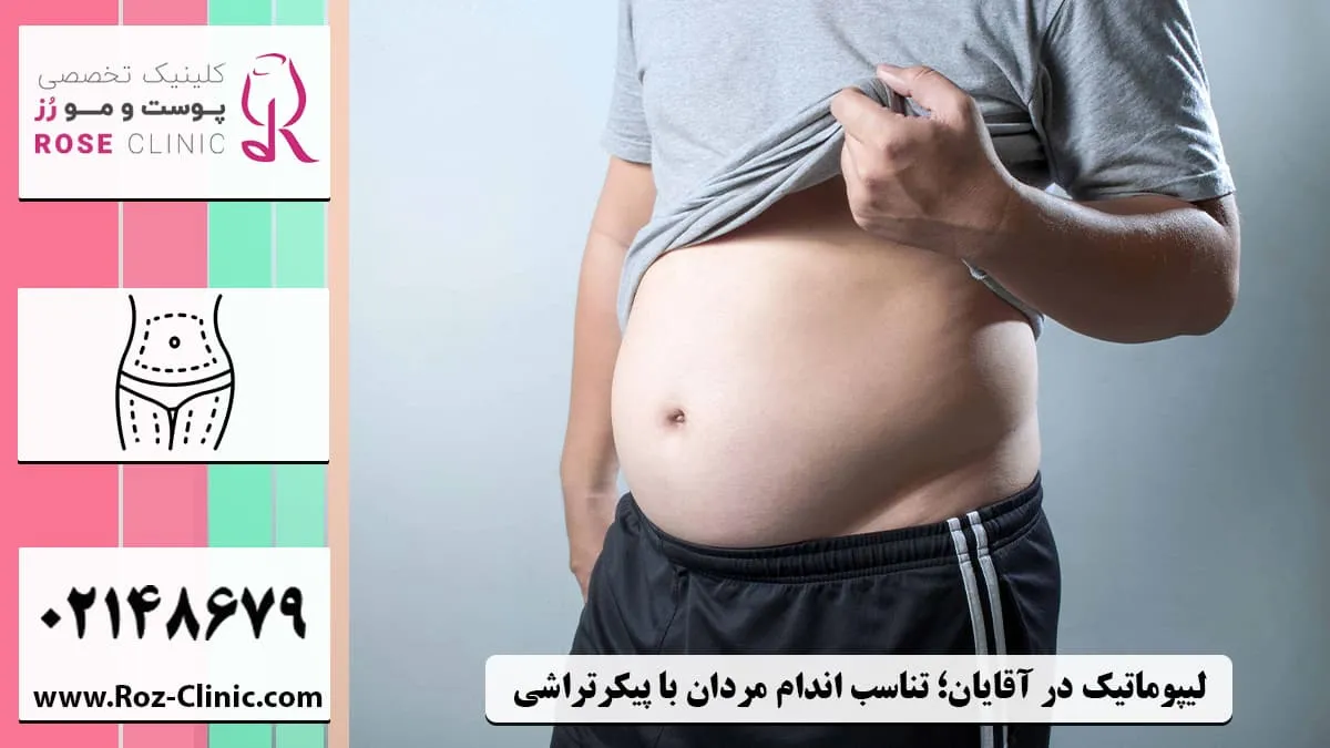 لیپوماتیک در مردان چاق