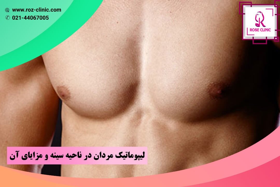 لیپوماتیک مردان در ناحیه سینه و مزایای آن