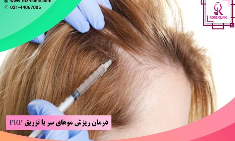 درمان ریزش موهای سر با تزریق PRP