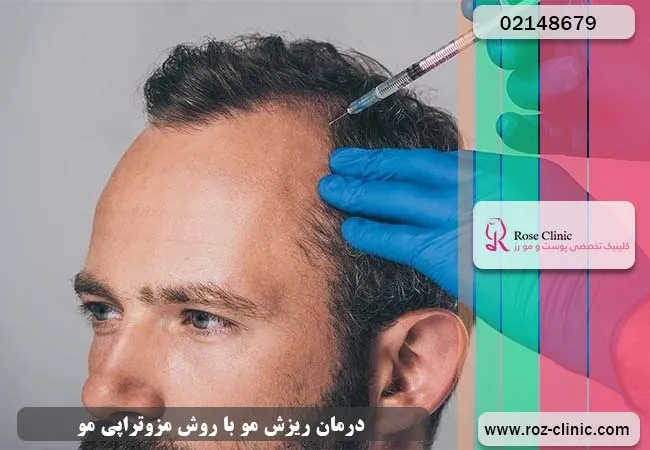 درمان ریزش مو با مزوتراپی 
