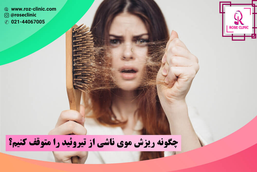 درمان ریزش موی تیروئیدی 1