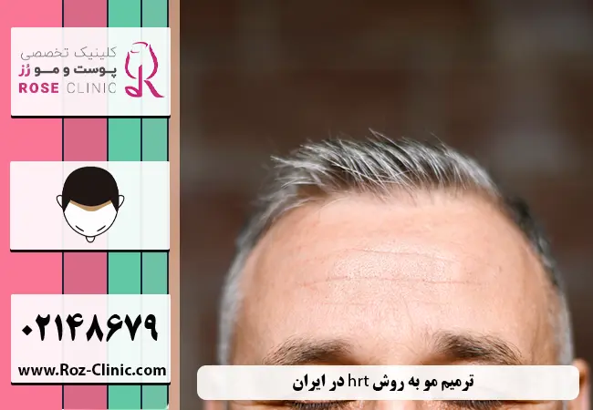 ترمیم مو به روش hrt در ایران