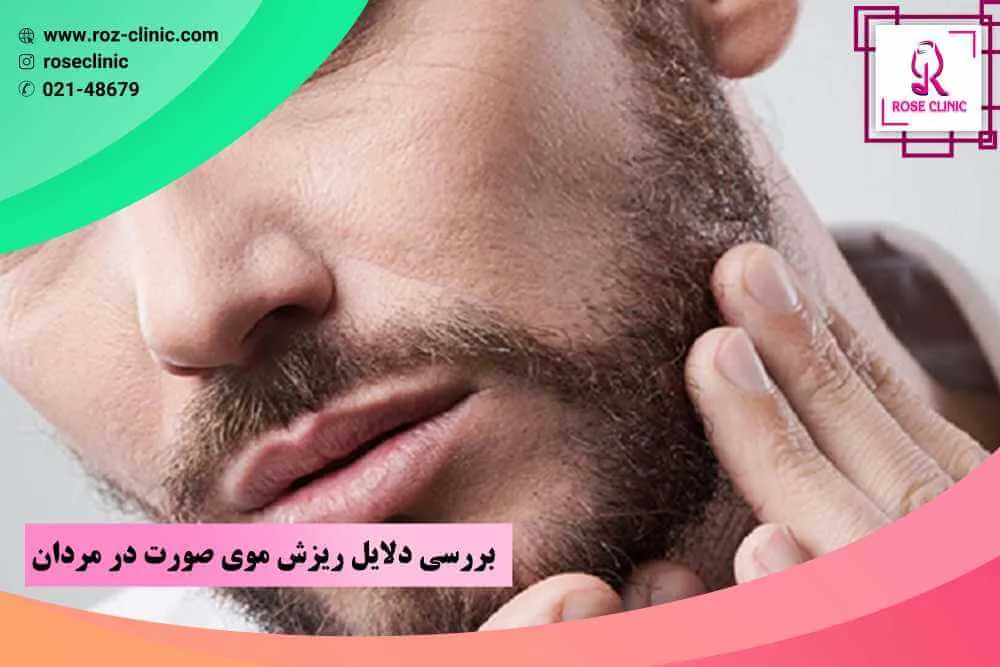 دلایل ریزش موی صورت مردان